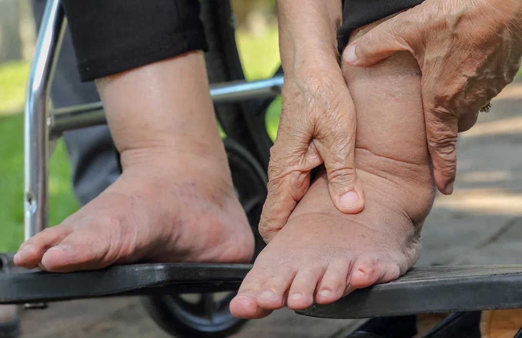 Проблемы с ногами у пожилого
